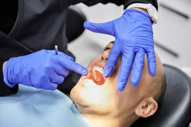 Best Walk-In Emergency Dentist in Lifornia City, CA