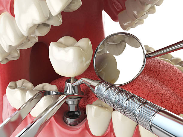 Best Emergency Orthodontic Repairs in Lifornia City, CA